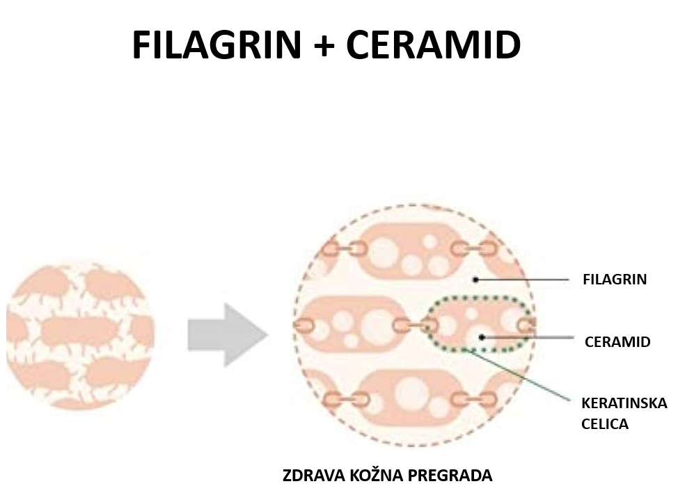 Genetska predispozicija serboričnega dermatitisa pri dojenčkih